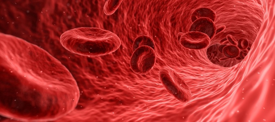 Anemia - niskie żelazo – przyczyny, objawy i rozwiązania